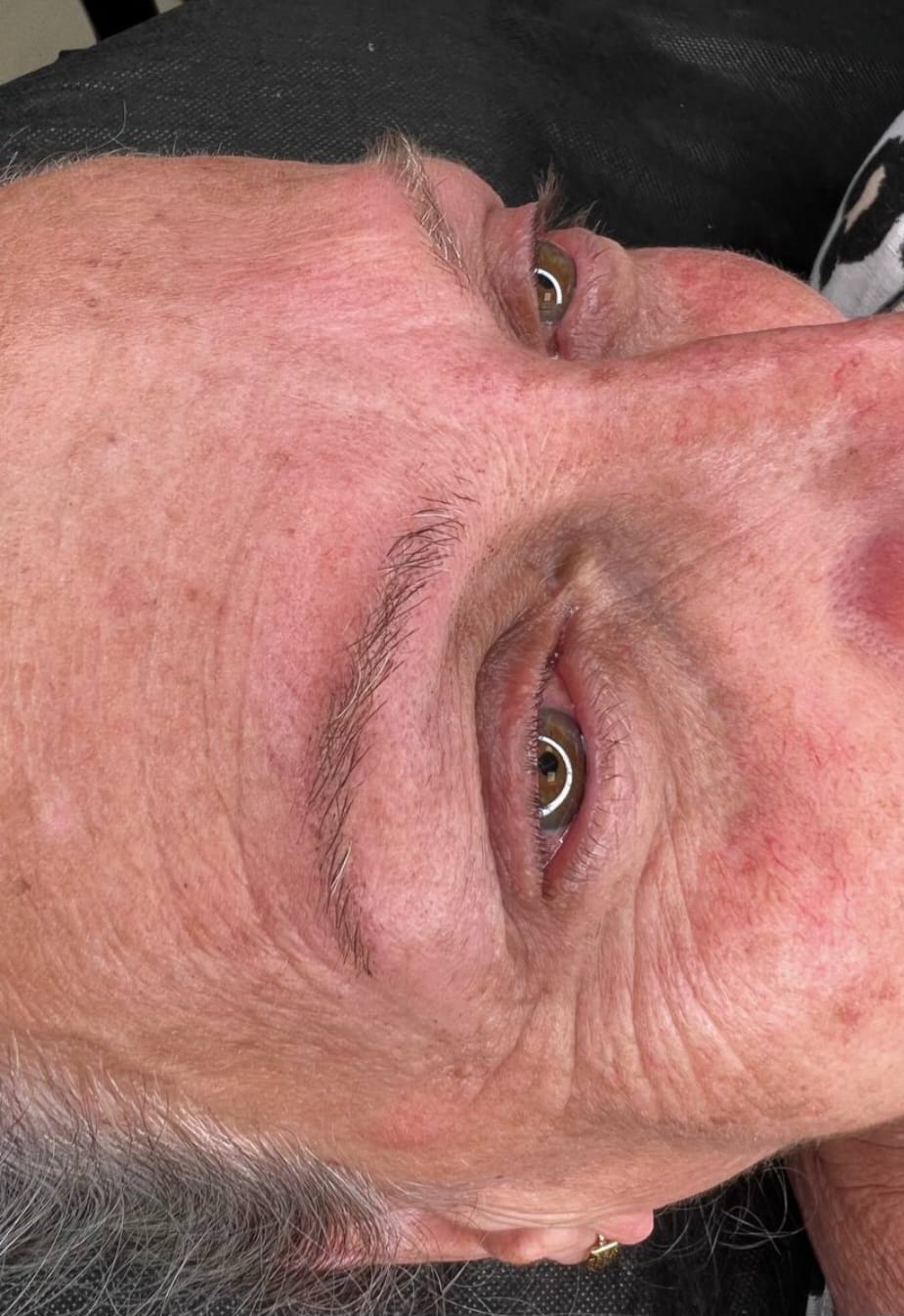 מיקרובליידינג 1